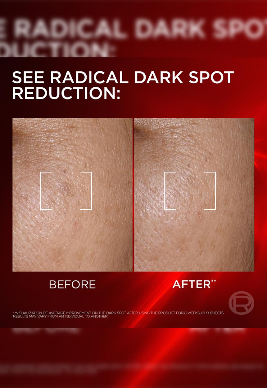 L'Oreal Paris - Revitalift Laser Triple Power Creamy Serum