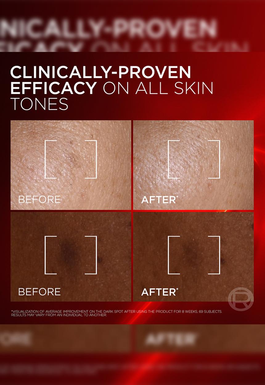 L'Oreal Paris - Revitalift Laser Triple Power Creamy Serum