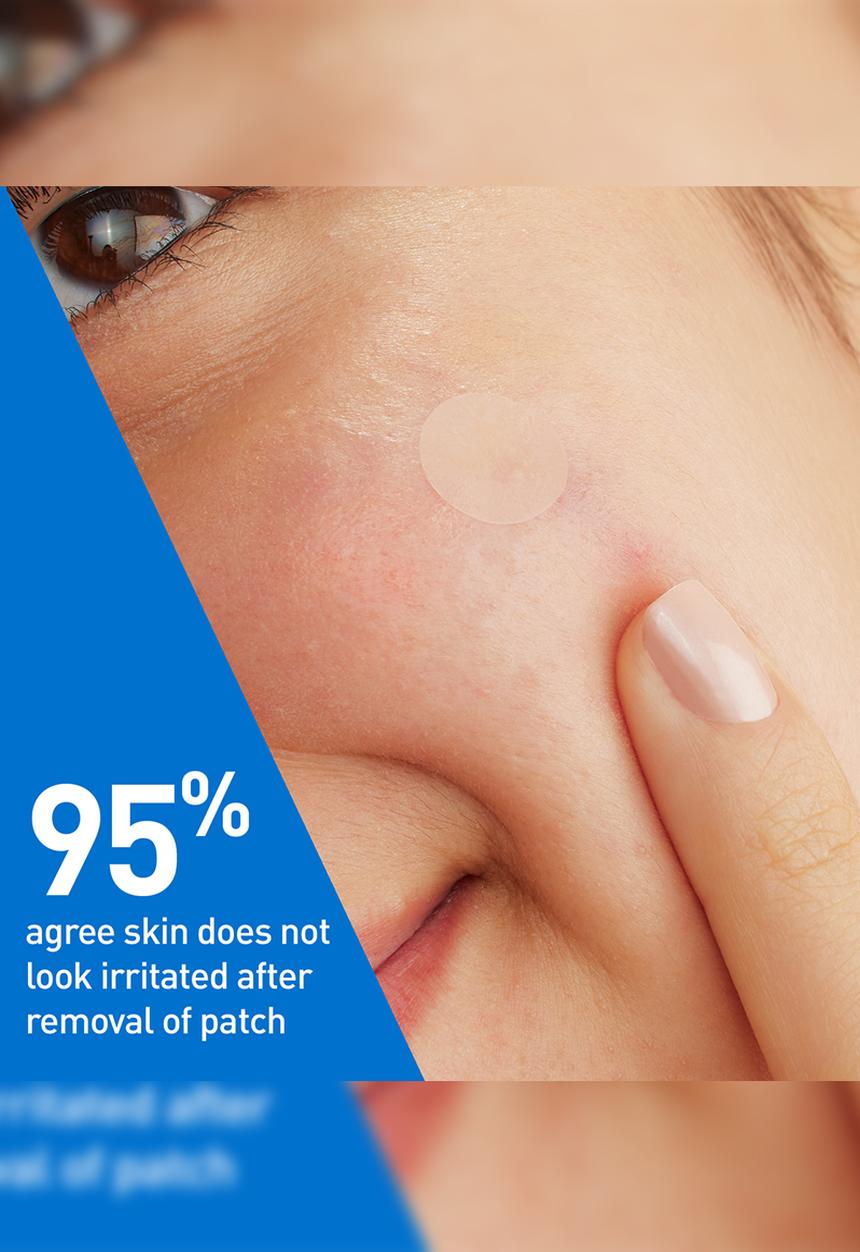 CeraVe® - Blemish Barrier Patches - 22 Piece