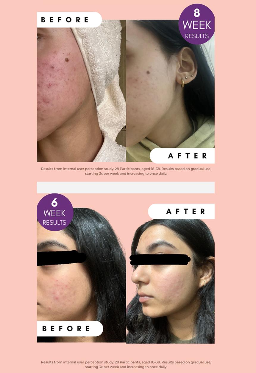 Standard Beauty - Pigmentation Buster Duo™ Dual-Phase Brightening System with Vitamin C & Alpha Arbutin