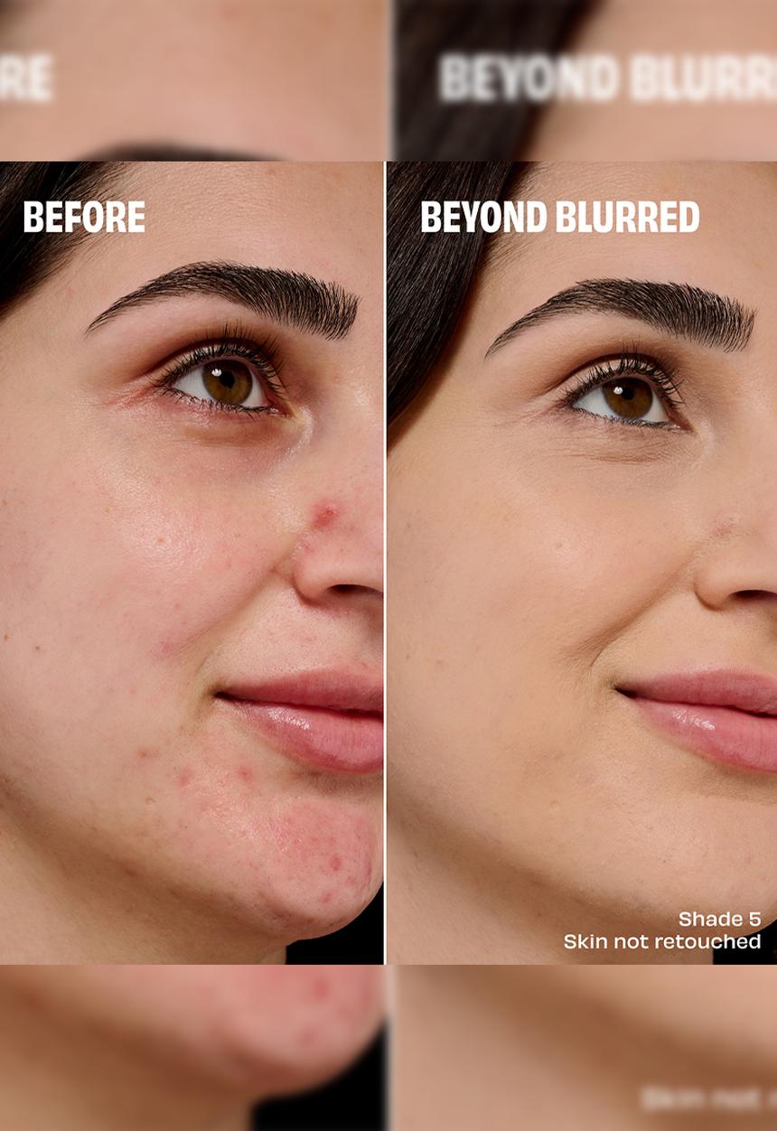 Benefit Cosmetics - The POREfessional Concealer - 5N GO Light Neutral